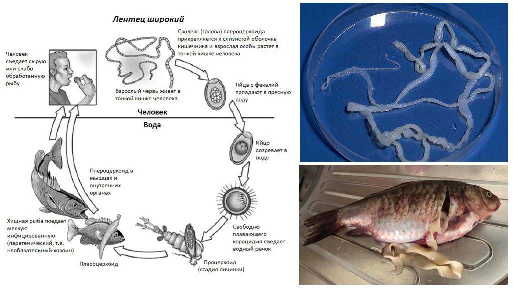 Гельминты рыб  и как ими не заразиться