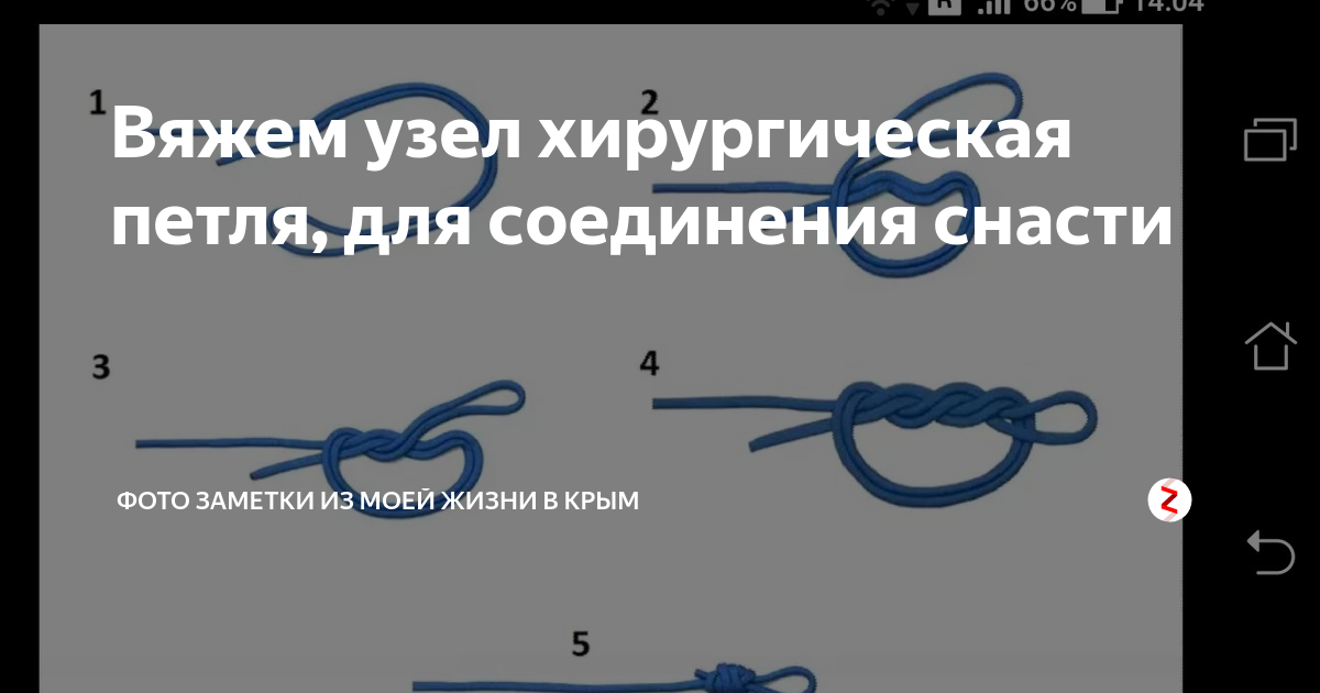 Хирургический узел. Рыболовные узлы хирургическая петля. Хирургический узел для фидера. Хирургическая петля на леске для фидера. Поводки хирургическим узлом.